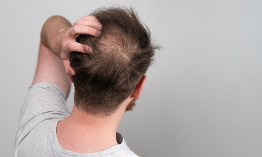 What To Expect After Using Fulvic Acid To Treat Hair Loss